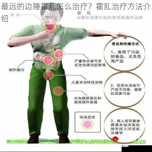 最远的边陲霍乱怎么治疗？霍乱治疗方法介绍